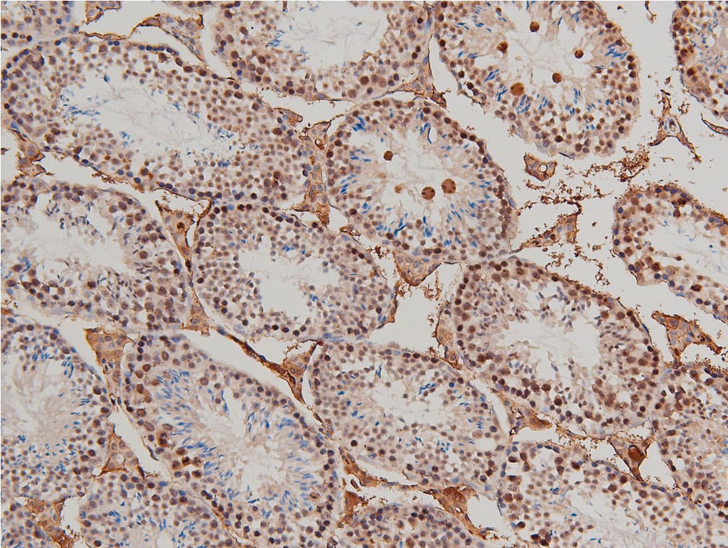 LIMK1 / LIMK Antibody (phospho-Thr508)