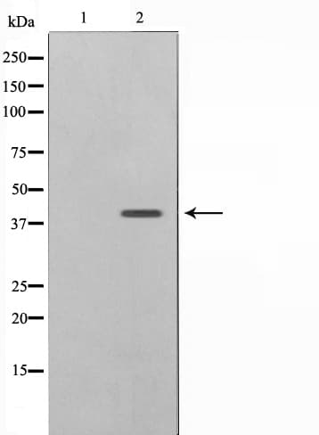Polyclonal Rabbit anti-Human APG4B / ATG4B Antibody (IHC, IF, WB)