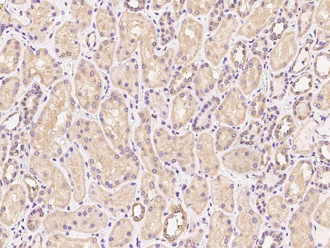 Polyclonal Rabbit anti-Human TATDN1 Antibody (IHC, IF)