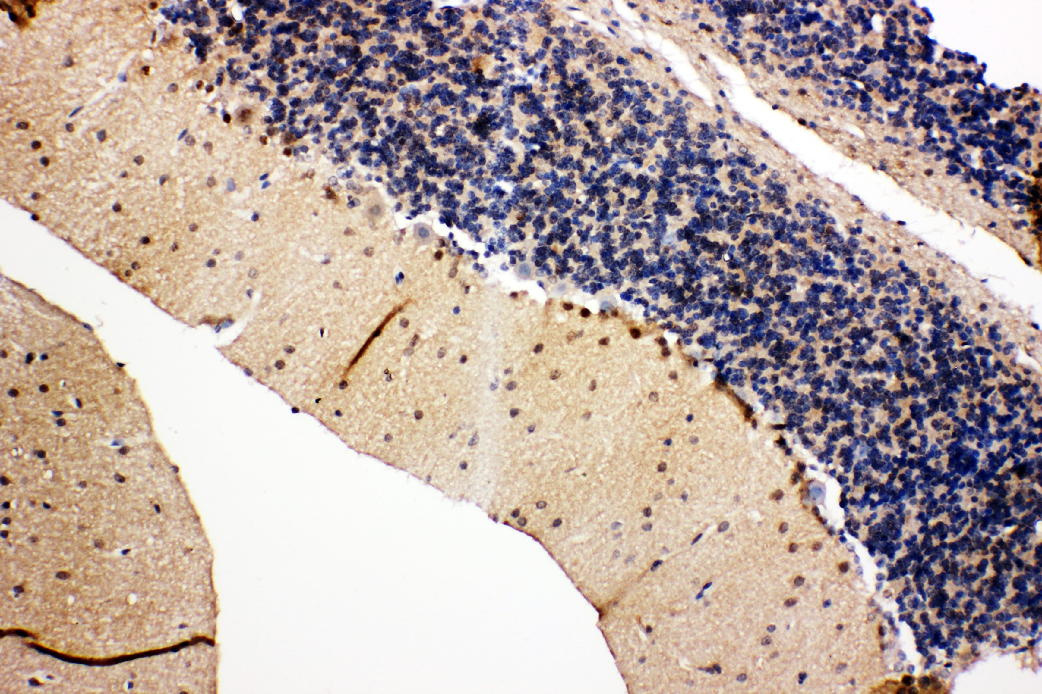 Polyclonal Rabbit anti-Human VCP Antibody (aa749-766, IHC, WB)