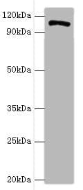 HIP1 Antibody (aa410-690)