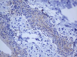 BCL10 / BCL-10 Antibody (clone OTI9C2, Carrier-free)