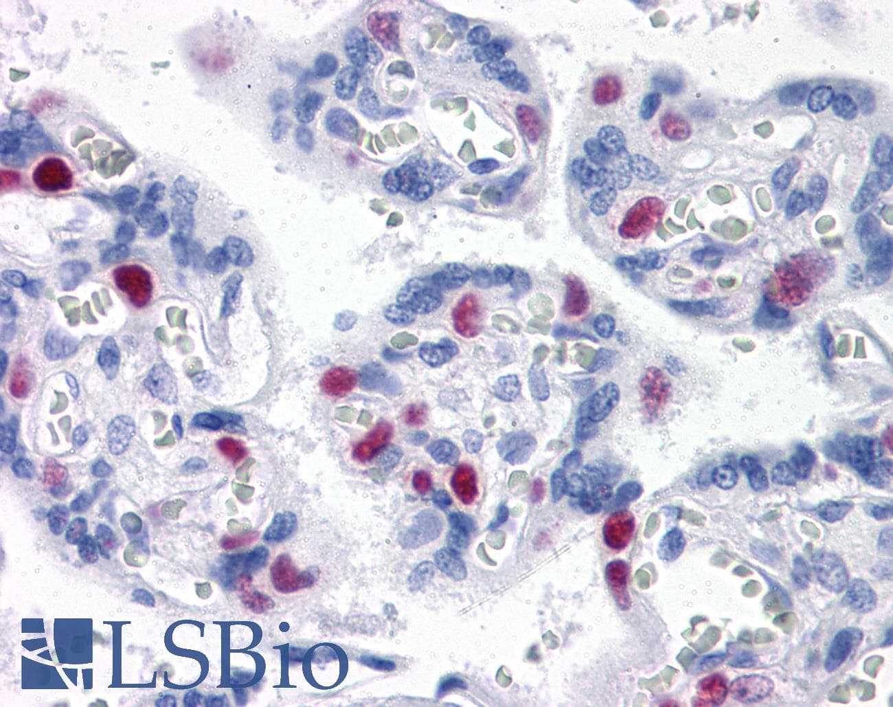 IHC-plus™ Monoclonal Mouse anti-Human EPSTI1 Antibody (clone 2A8, IHC, WB)