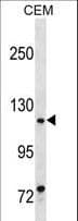 Polyclonal Rabbit anti-Human BSAC / MKL1 Antibody (aa497-525, WB)
