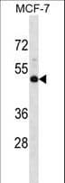 NMBR Antibody (aa1-30)