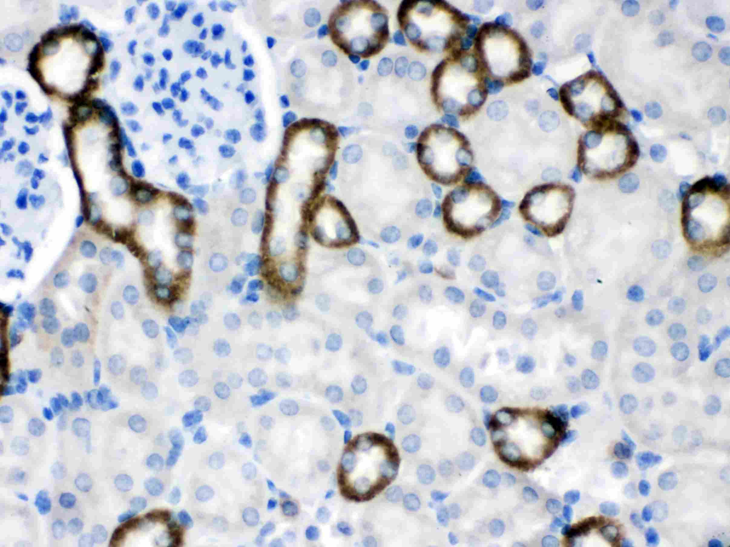 Polyclonal Rabbit anti-Human CASR/Calcium Sensing Receptor Antibody (IHC, WB)