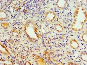PIKFYVE / PIP5K Antibody (aa1819-2098)