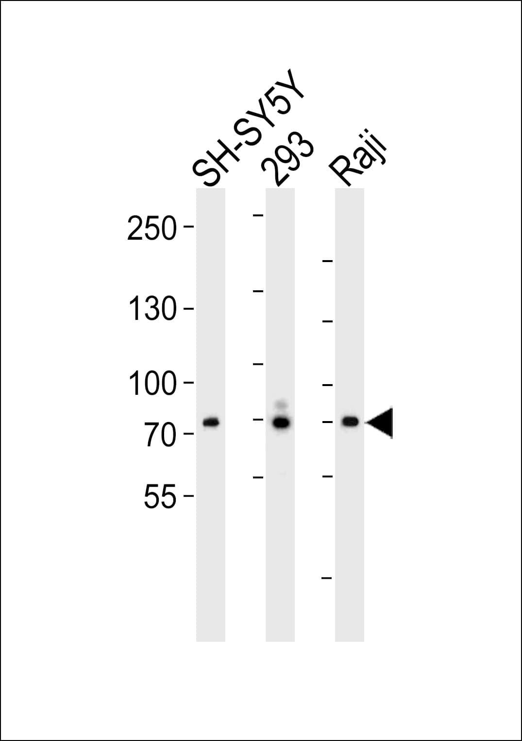 Polyclonal Rabbit anti-Human FGFR4 Antibody (aa24-55, IHC, IF, WB)