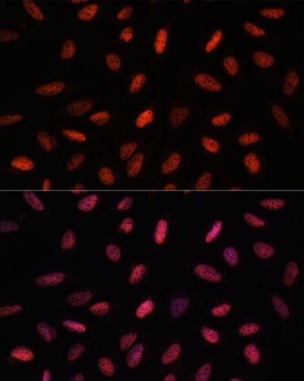 ARID1B / BAF250B Antibody