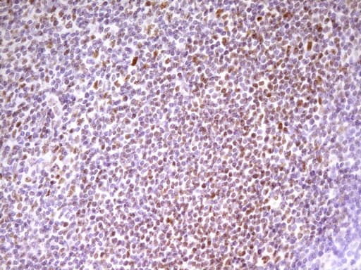 Monoclonal Mouse anti-Human SP110 Antibody (clone OTI4C1, aa232-521, IHC, WB)