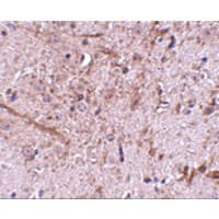 TOMM70A Antibody