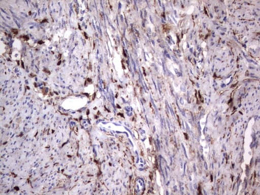 LGALS3 / Galectin 3 Antibody (clone UMAB157, Carrier-free)