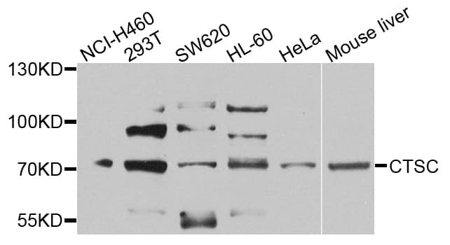 CTSC / Cathepsin C / JP Antibody