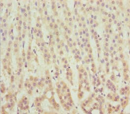 Polyclonal Rabbit anti-Human MSRB3 Antibody (IHC, WB)