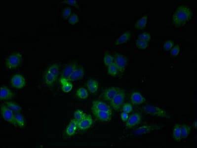 Polyclonal Rabbit anti-Human LDLRAD1 Antibody