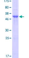 Human PRSS3 / Trypsin 3 Protein (Recombinant GST)