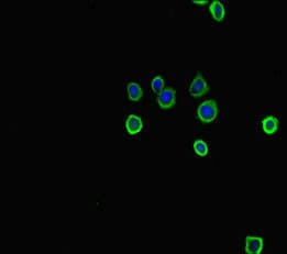 TPH1 / Tryptophan Hydroxylase Antibody