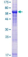Human TUBAL3 Protein (Recombinant GST)