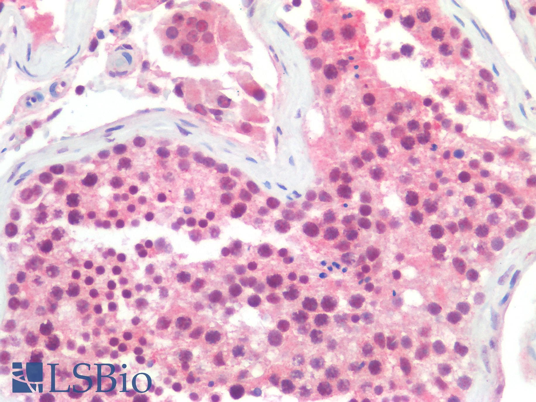 IHC-plus™ Polyclonal Rabbit anti-Human SIAH2 Antibody (IHC)