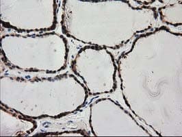 Monoclonal Mouse anti-Human PYCRL Antibody (clone OTI1B12, IHC, IF, WB)