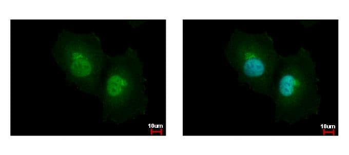 IHC-plus™ ASL / Argininosuccinate Lyase Antibody (aa86-325)