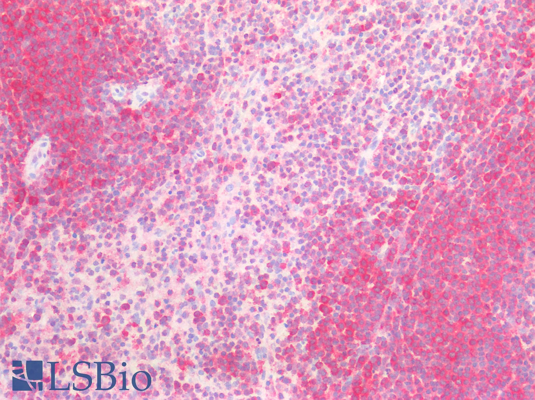 PathPlus™ IL6ST / CD130 / gp130 Antibody