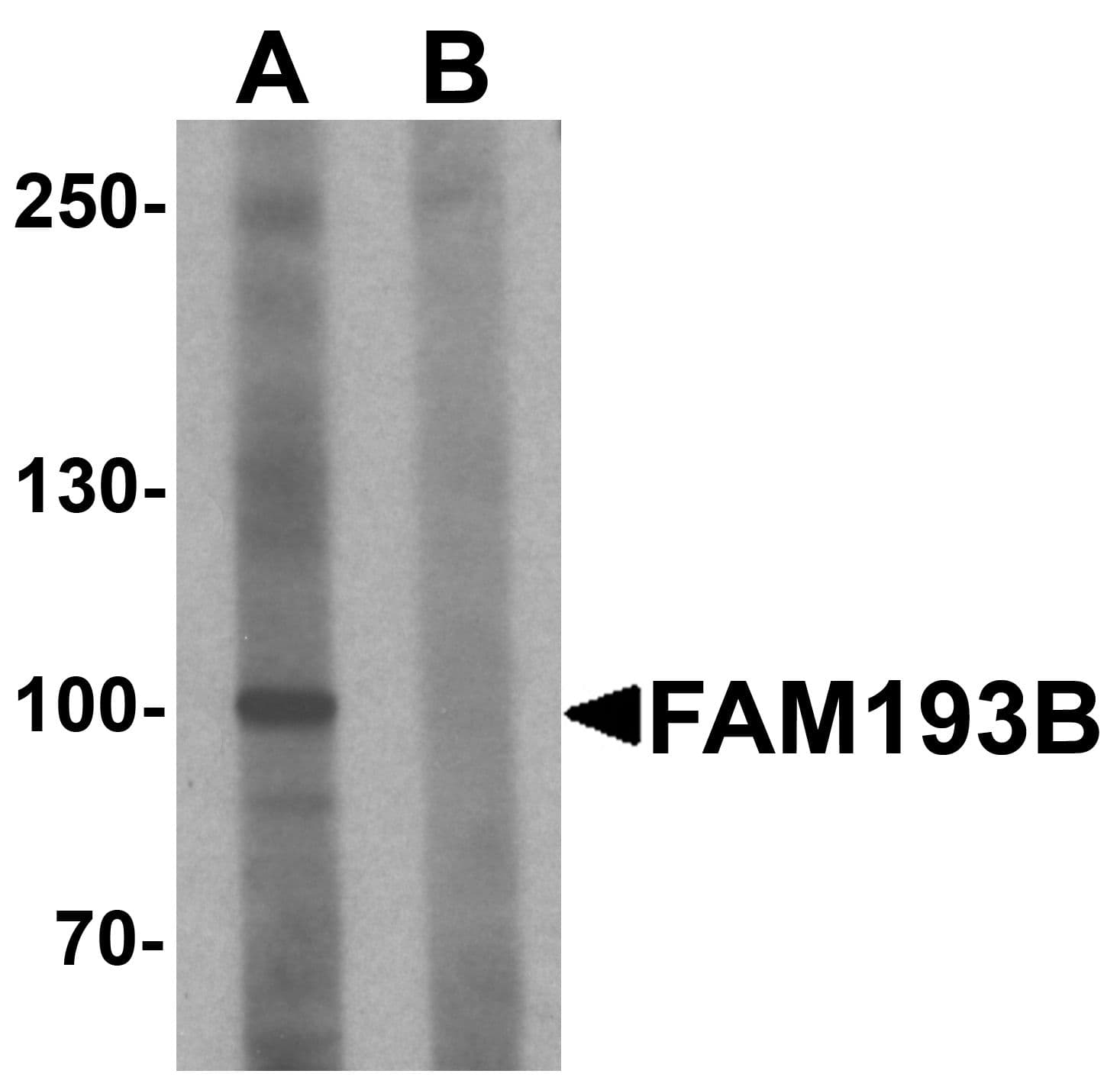 IHC-plus™ FAM193B Antibody