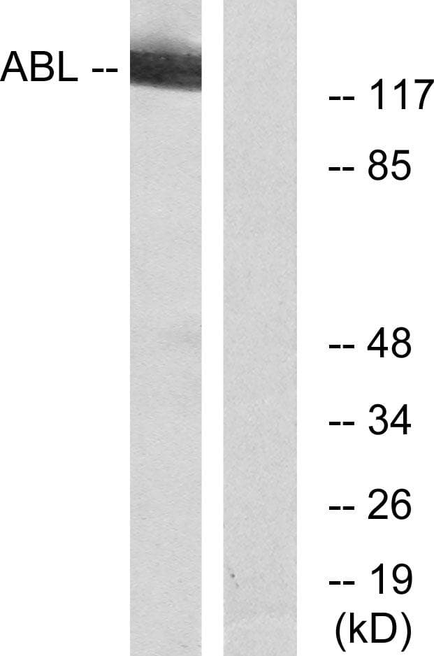 ABI2B / ABI2 Antibody (p412)