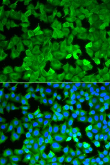 IHC-plus™ Polyclonal Rabbit anti-Human ASNS Antibody (IHC, IF, WB)