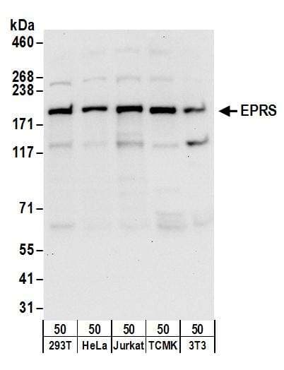 IHC-plus™ RPL5 / Ribosomal Protein L5 Antibody (aa247-297)