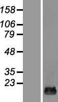 HSPC176 / TRAPPC2L Protein (Over-Expression Lysate Myc-DDK (Flag))