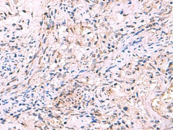 Polyclonal Rabbit anti-Human INPP5B Antibody (IHC)