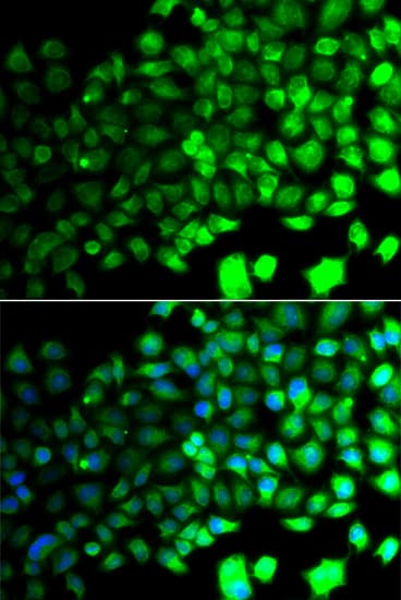 PRKAA2 / AMPK Alpha 2 Antibody