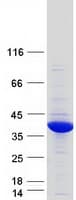 Human GPD1L Protein (Recombinant Myc-DDK (Flag))