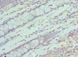 Polyclonal Rabbit anti-Human SF3B2 Antibody (aa616-895, IHC)