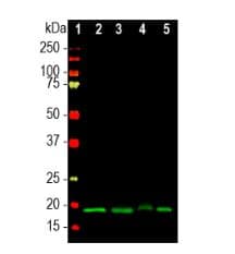 IHC-plus™ Monoclonal Mouse anti-Human VILIP / VSNL1 Antibody (clone 2D11, IHC, IF, WB)