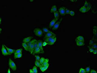 Polyclonal Rabbit anti-Human 15-PGDH / HPGD Antibody (IHC, IF)