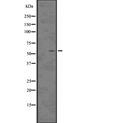 Polyclonal Rabbit anti-Human CDKN1C / p57 Kip2 Antibody (phospho-Thr310, IF, WB)