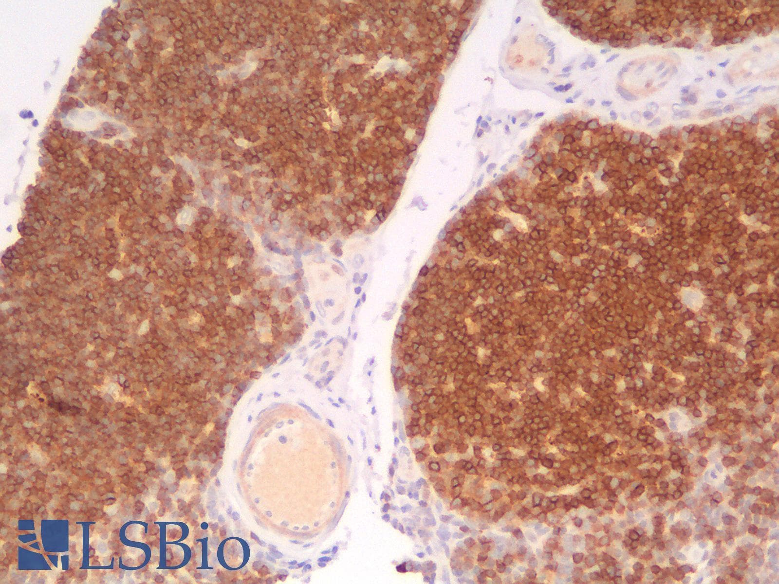 PathPlus™ CD1A Antibody (clone rC1A/711)