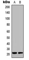 DUSP22 / JSP 1 Antibody (Internal)