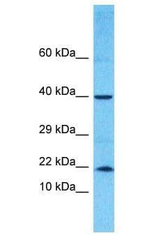 Polyclonal Rabbit anti-Human TNFAIP8L2 Antibody (aa11-60, WB)