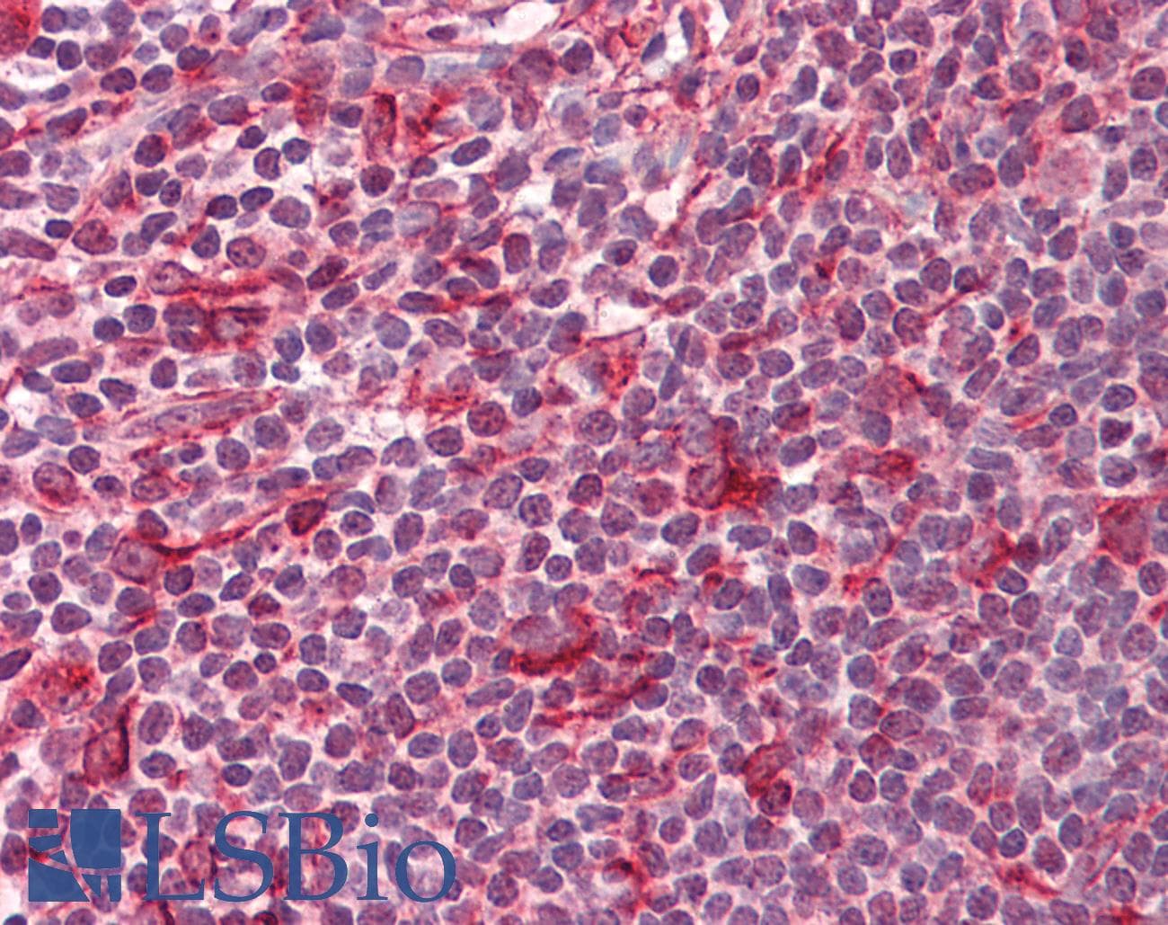 IHC-plus™ HDAC1 Antibody (aa387-436)