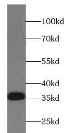 CD74 / CLIP Antibody