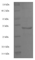 Human LSP1 Protein (Recombinant GST, N-terminus)