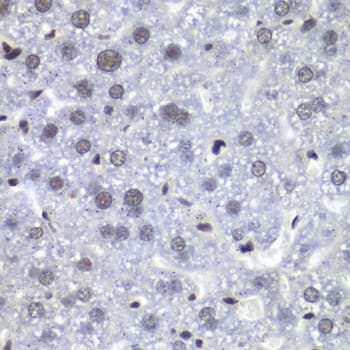 Polyclonal Rabbit anti-Human RBBP5 Antibody (IHC, IF, WB)