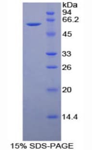 Mouse CD34 Protein (Recombinant His-GST)