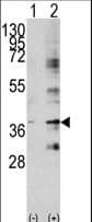 BIRC7 / Livin Antibody (aa271-298)
