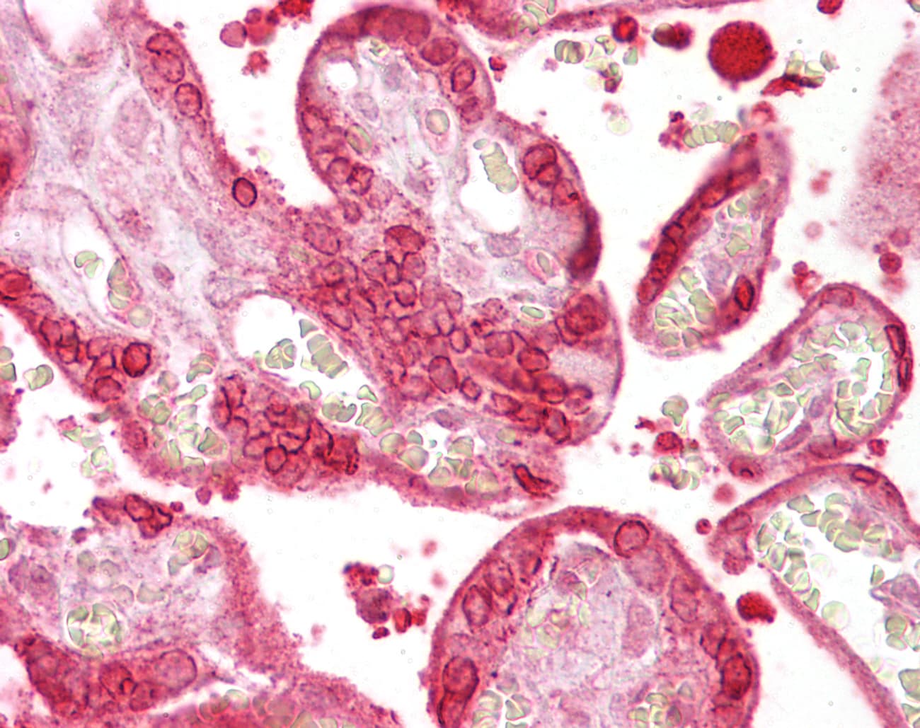 Polyclonal Rabbit anti-Human ANXA1 / Annexin A1 Antibody (aa41-90, IHC)