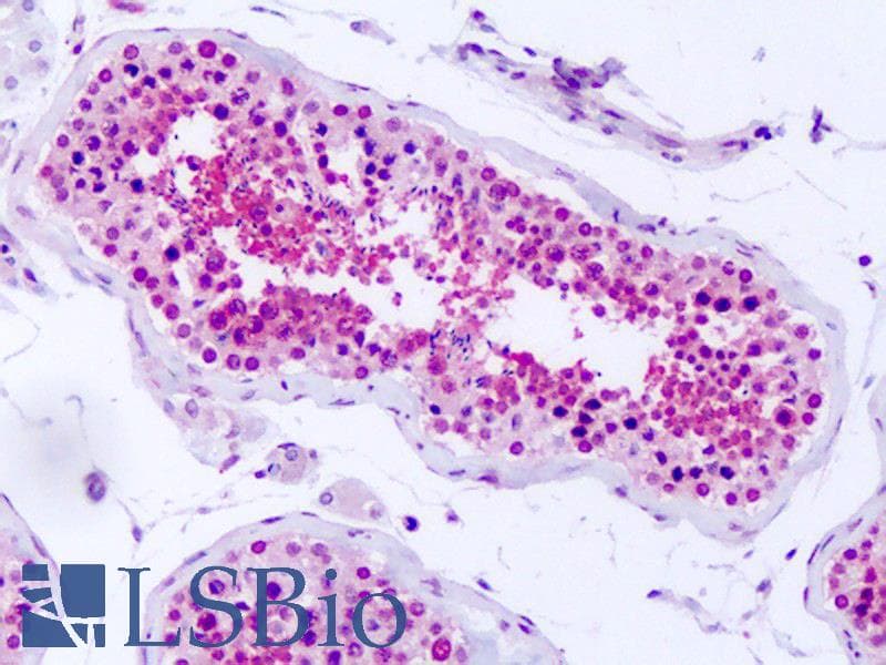 IHC-plus™ Polyclonal Rabbit anti-Human PRKD2 / PKD2 Antibody (Internal, IHC)