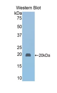 HP / Haptoglobin Antibody (aa118-281)